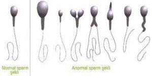 Sperm Şekilleri